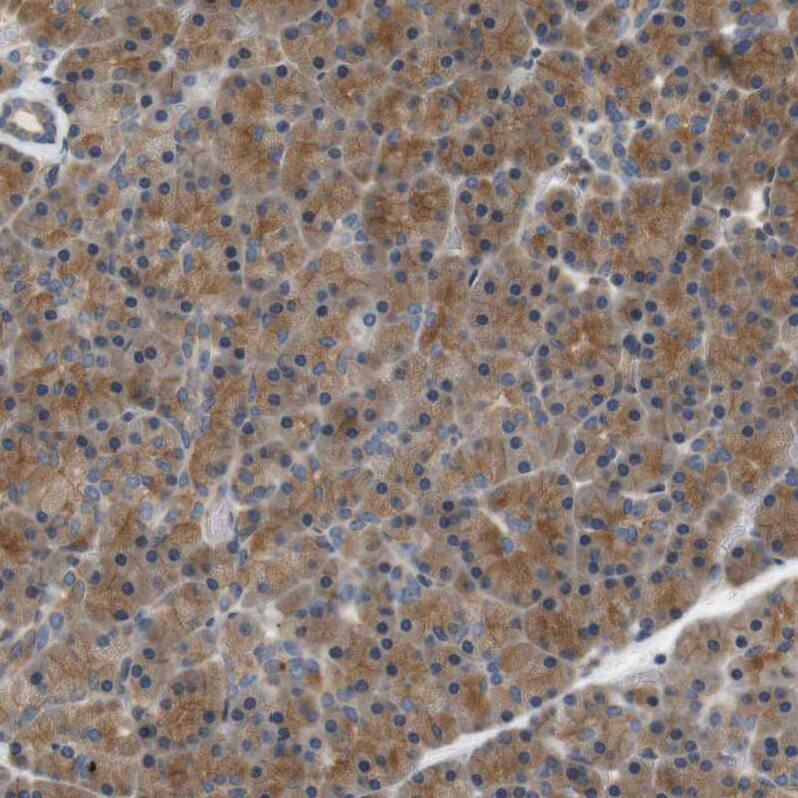 Endophilin B1/Bif-1 Antibody - BSA Free Immunohistochemistry-Paraffin: Endophilin B1/Bif-1 Antibody - BSA Free [NBP1-89972]