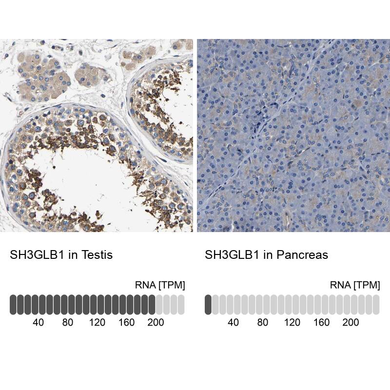 Endophilin B1/Bif-1 Antibody - BSA Free Immunohistochemistry-Paraffin: Endophilin B1/Bif-1 Antibody - BSA Free [NBP1-89973]