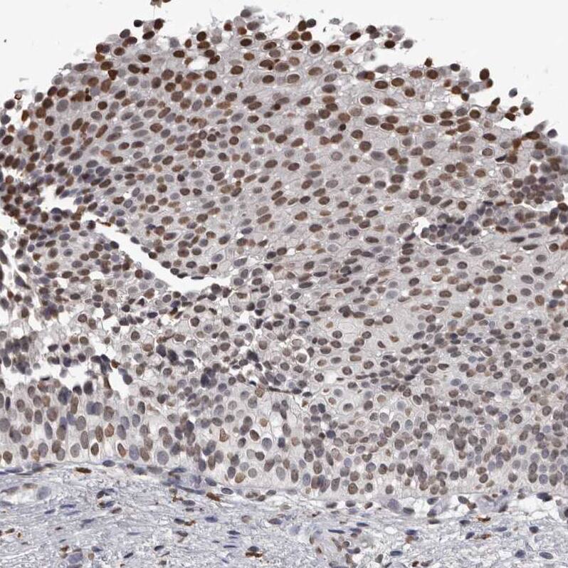 AHR Antibody - BSA Free Immunohistochemistry-Paraffin: AHR Antibody - BSA Free [NBP1-89975]