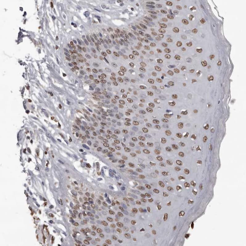 AHR Antibody - BSA Free Immunohistochemistry-Paraffin: AHR Antibody - BSA Free [NBP1-89975]
