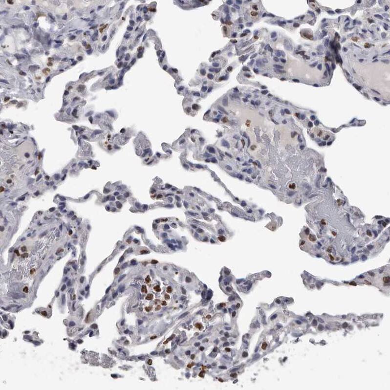 AHR Antibody - BSA Free Immunohistochemistry-Paraffin: AHR Antibody - BSA Free [NBP1-89975]