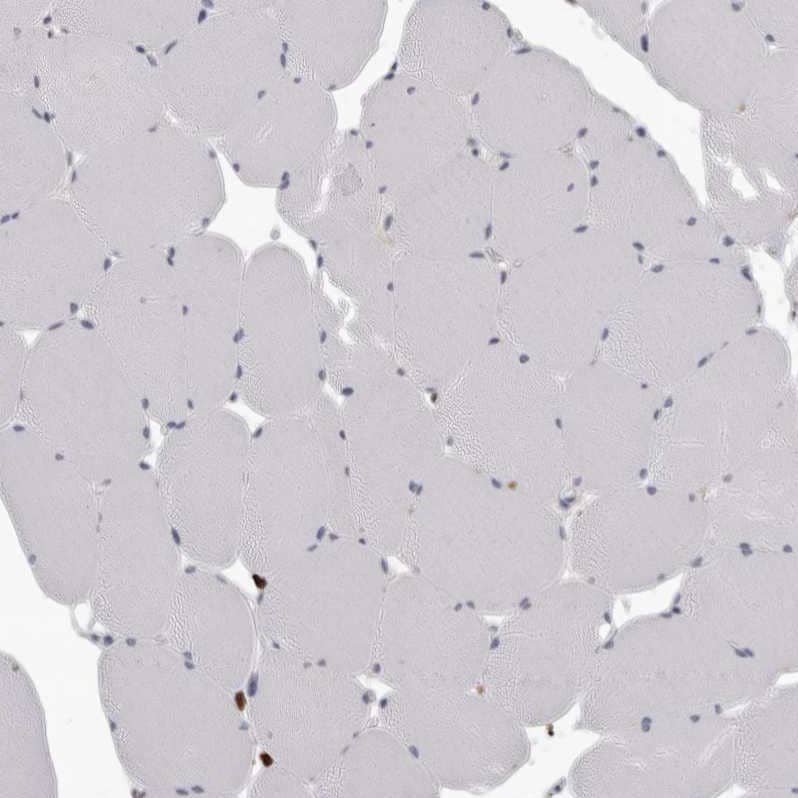AHR Antibody - BSA Free Immunohistochemistry-Paraffin: AHR Antibody - BSA Free [NBP1-89975]
