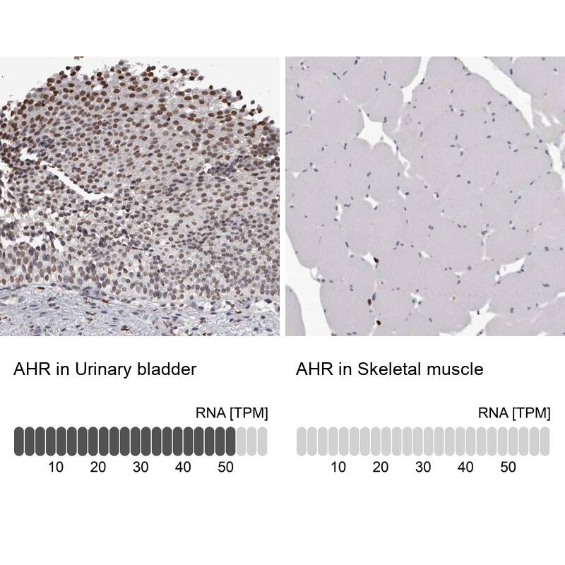 AHR Antibody - BSA Free Immunohistochemistry-Paraffin: AHR Antibody - BSA Free [NBP1-89975]