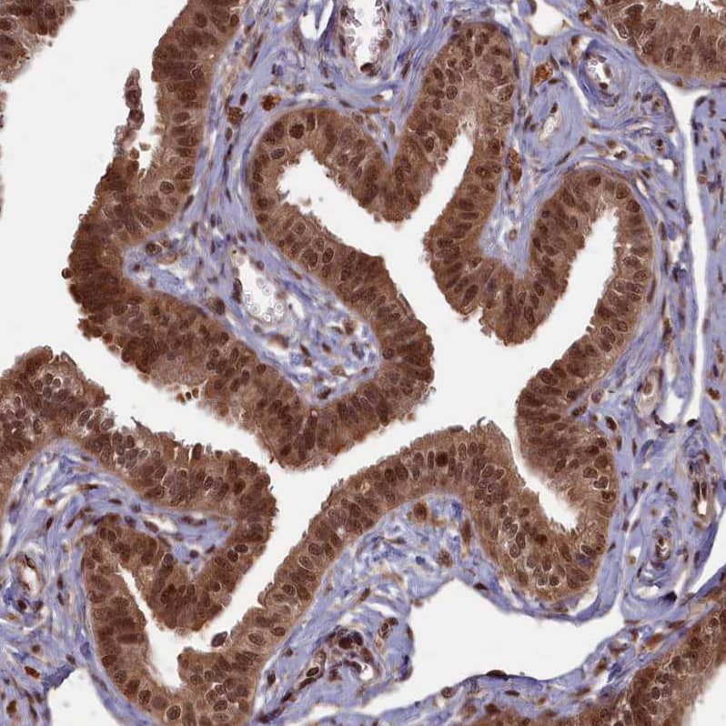 HIF-3 alpha Antibody - BSA Free Immunohistochemistry-Paraffin: HIF-3 alpha Antibody - BSA Free [NBP1-89977]