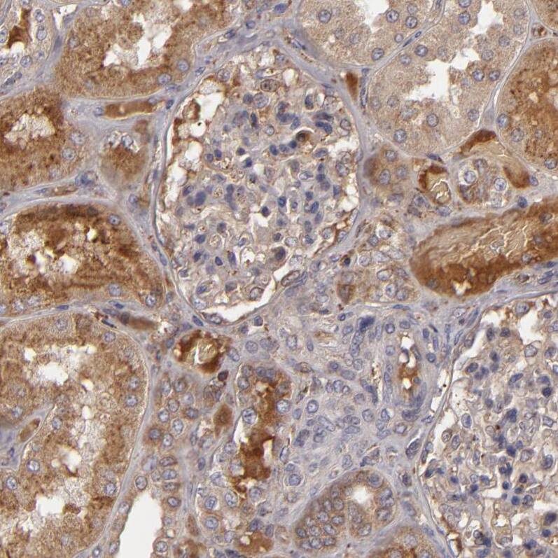 Complement Factor B Antibody - BSA Free Immunohistochemistry-Paraffin: Complement Factor B Antibody - BSA Free [NBP1-89985]