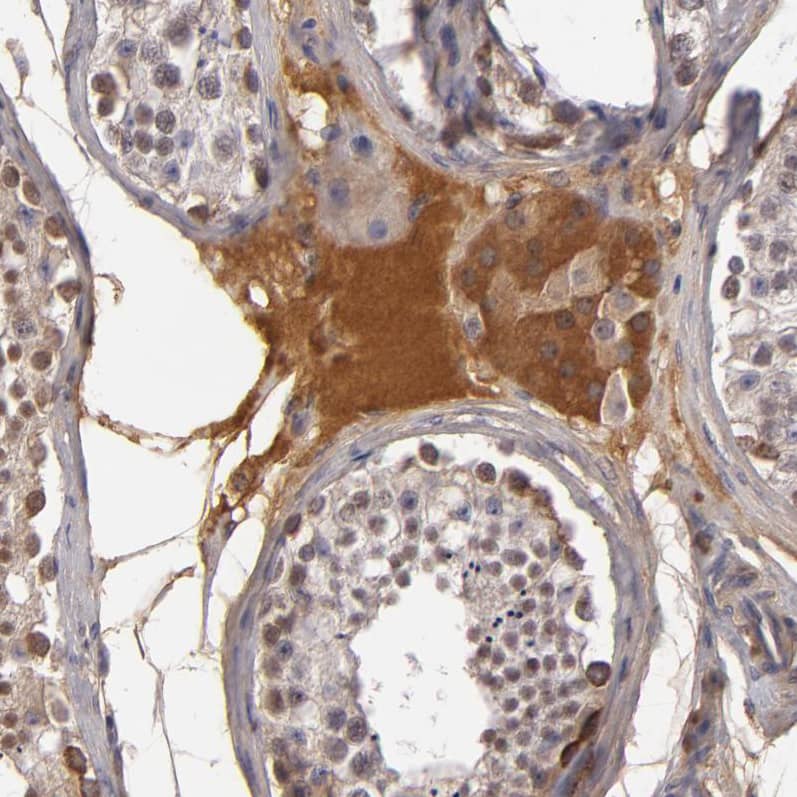 Complement Factor B Antibody - BSA Free Immunohistochemistry-Paraffin: Complement Factor B Antibody - BSA Free [NBP1-89985]