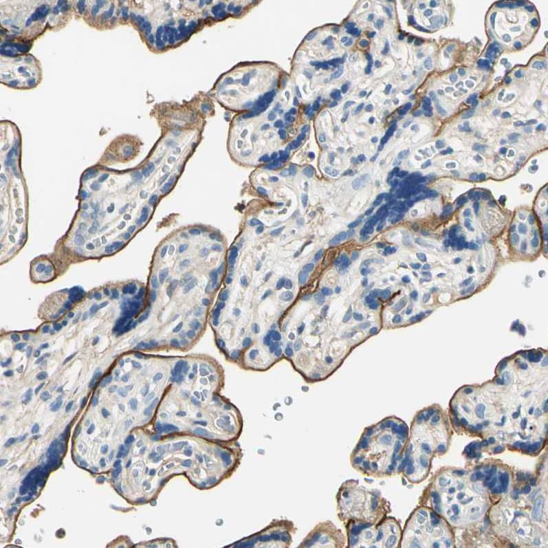 TGF-beta RIII Antibody - BSA Free Immunohistochemistry-Paraffin: TGF-beta RIII Antibody - BSA Free [NBP1-89988]