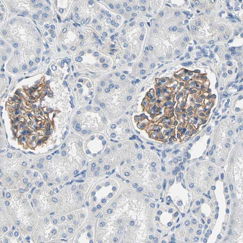 TGF-beta RIII Antibody - BSA Free Immunohistochemistry-Paraffin: TGF-beta RIII Antibody - BSA Free [NBP1-89988]