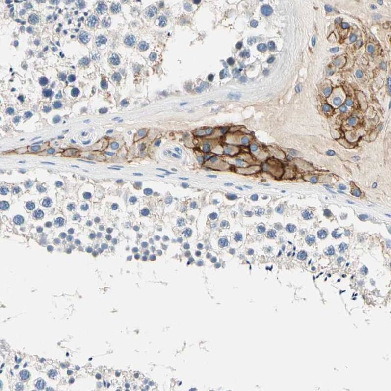 TGF-beta RIII Antibody - BSA Free Immunohistochemistry-Paraffin: TGF-beta RIII Antibody - BSA Free [NBP1-89988]