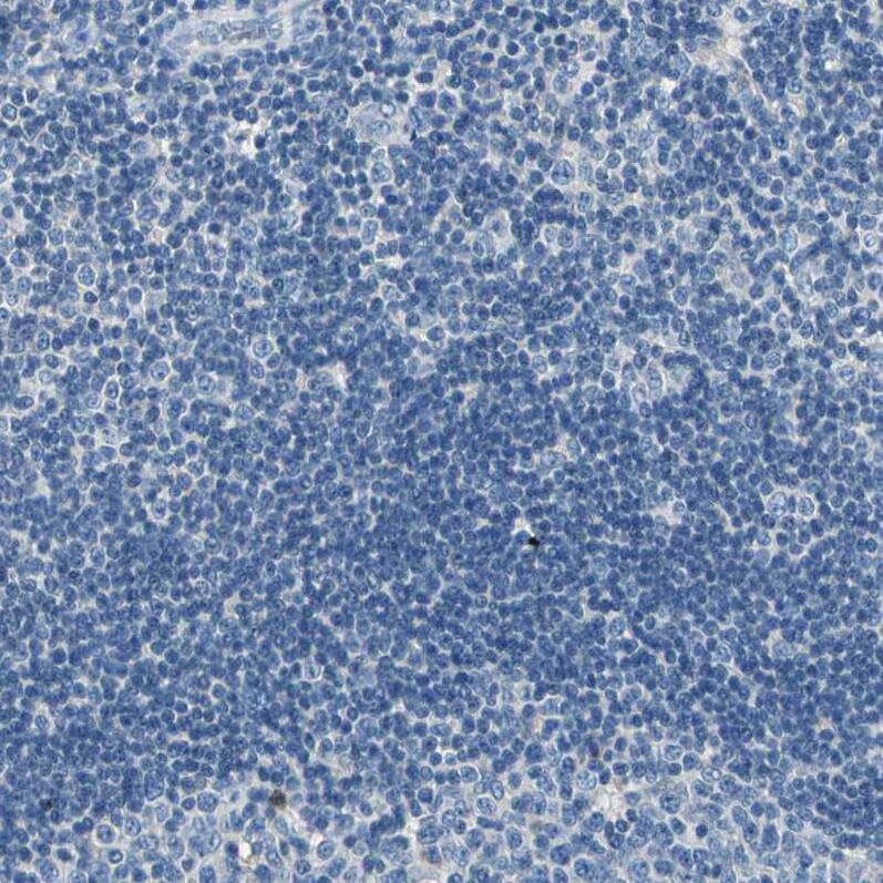 TGF-beta RIII Antibody - BSA Free Immunohistochemistry-Paraffin: TGF-beta RIII Antibody - BSA Free [NBP1-89988]