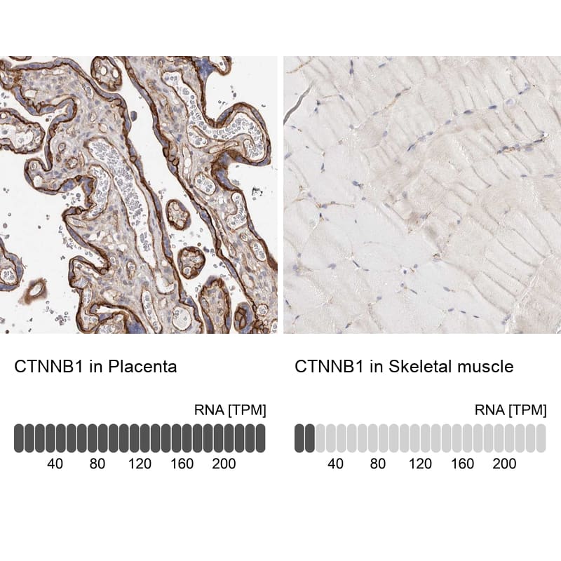 beta-Catenin Antibody - BSA Free Immunohistochemistry-Paraffin: beta-Catenin Antibody - BSA Free [NBP1-89990]