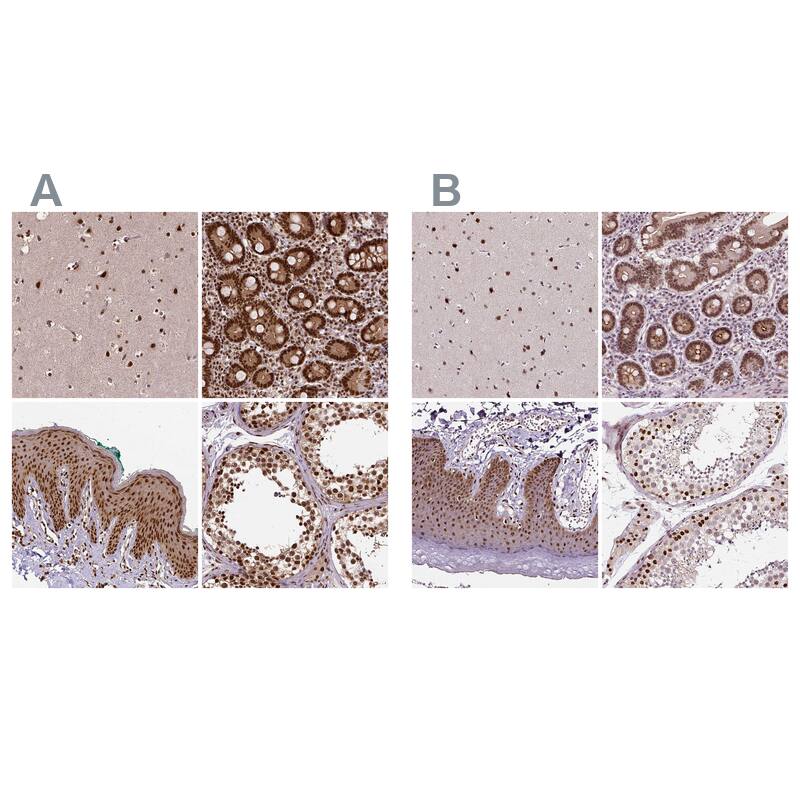 NAC1 Antibody - BSA Free Immunohistochemistry-Paraffin: NAC1 Antibody - BSA Free [NBP1-89991]