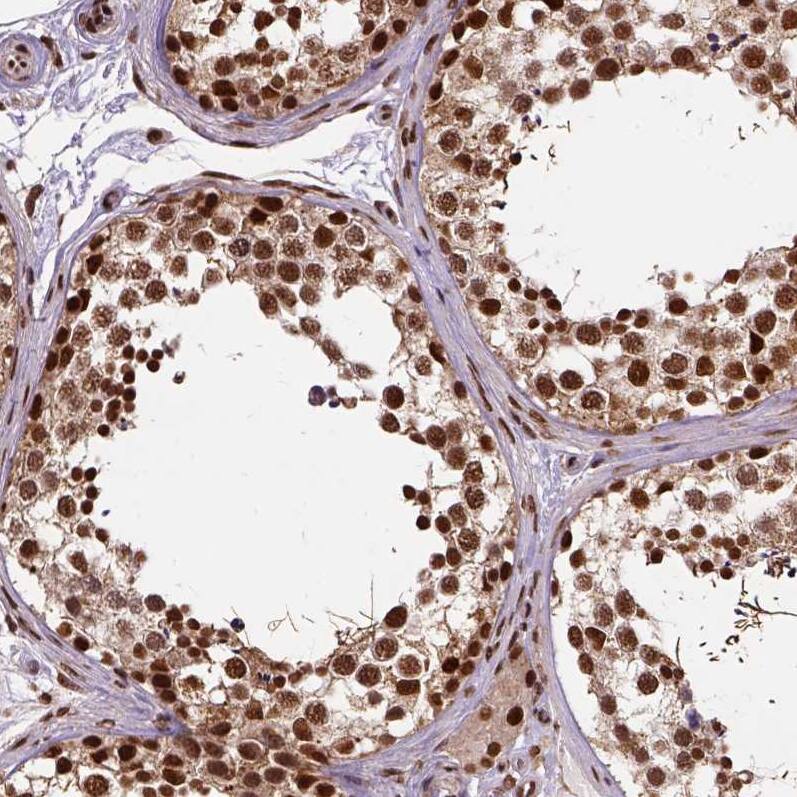 NAC1 Antibody - BSA Free Immunohistochemistry-Paraffin: NAC1 Antibody - BSA Free [NBP1-89991]