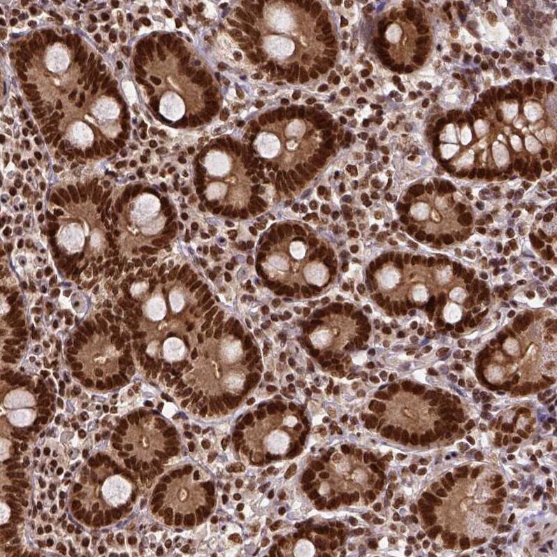 NAC1 Antibody - BSA Free Immunohistochemistry-Paraffin: NAC1 Antibody - BSA Free [NBP1-89991]