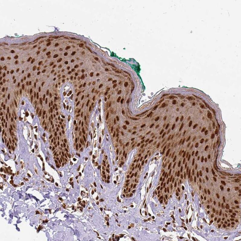 NAC1 Antibody - BSA Free Immunohistochemistry-Paraffin: NAC1 Antibody - BSA Free [NBP1-89991]