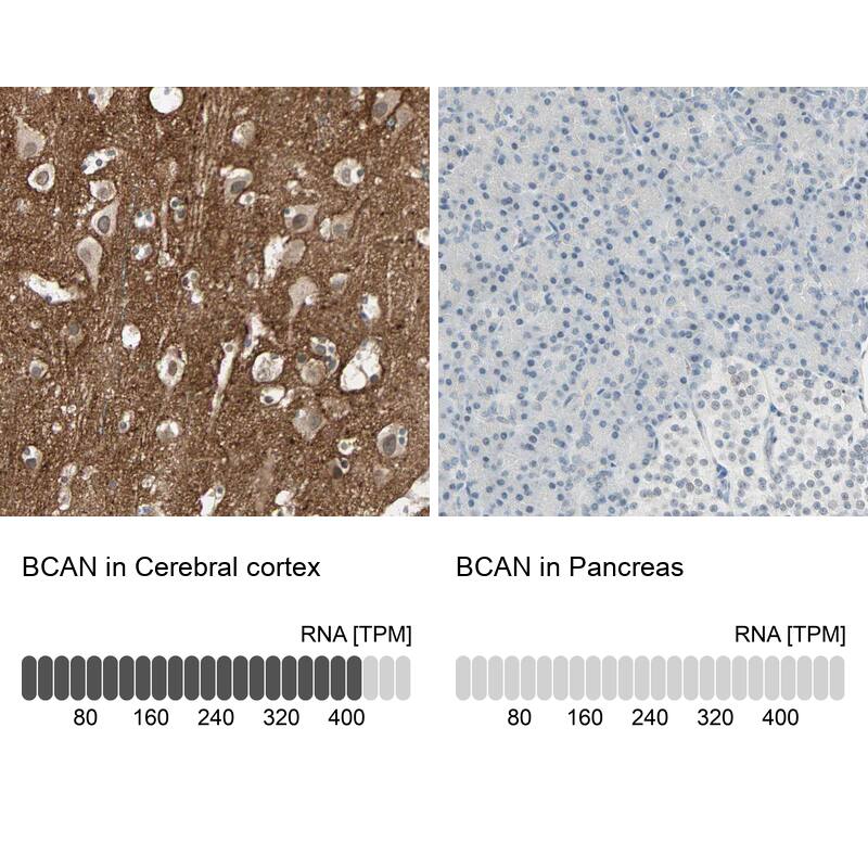 Brevican Antibody - BSA Free Immunohistochemistry-Paraffin: Brevican Antibody - BSA Free [NBP1-89992]