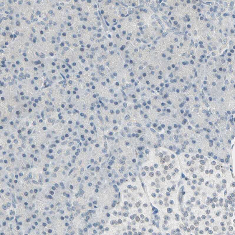 Brevican Antibody - BSA Free Immunohistochemistry-Paraffin: Brevican Antibody - BSA Free [NBP1-89992]
