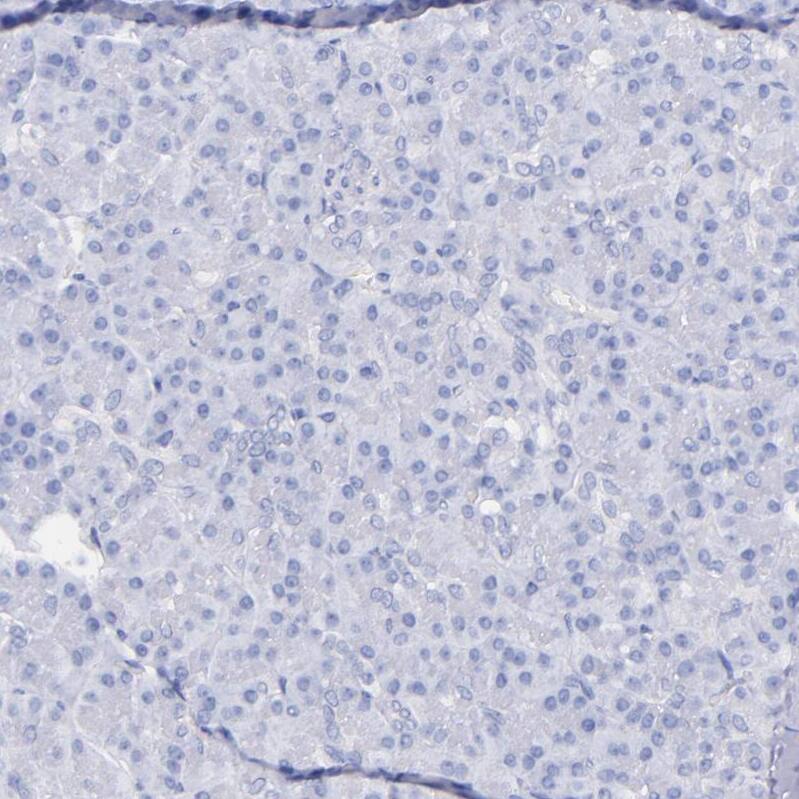 Kininogen Antibody - BSA Free Immunohistochemistry-Paraffin: Kininogen Antibody - BSA Free [NBP1-89993]