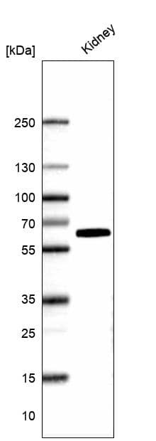 Kininogen Antibody - BSA Free Western Blot: Kininogen Antibody - BSA Free [NBP1-89993]