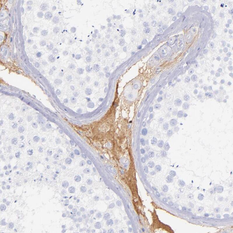Kininogen Antibody - BSA Free Immunohistochemistry-Paraffin: Kininogen Antibody - BSA Free [NBP1-89993]