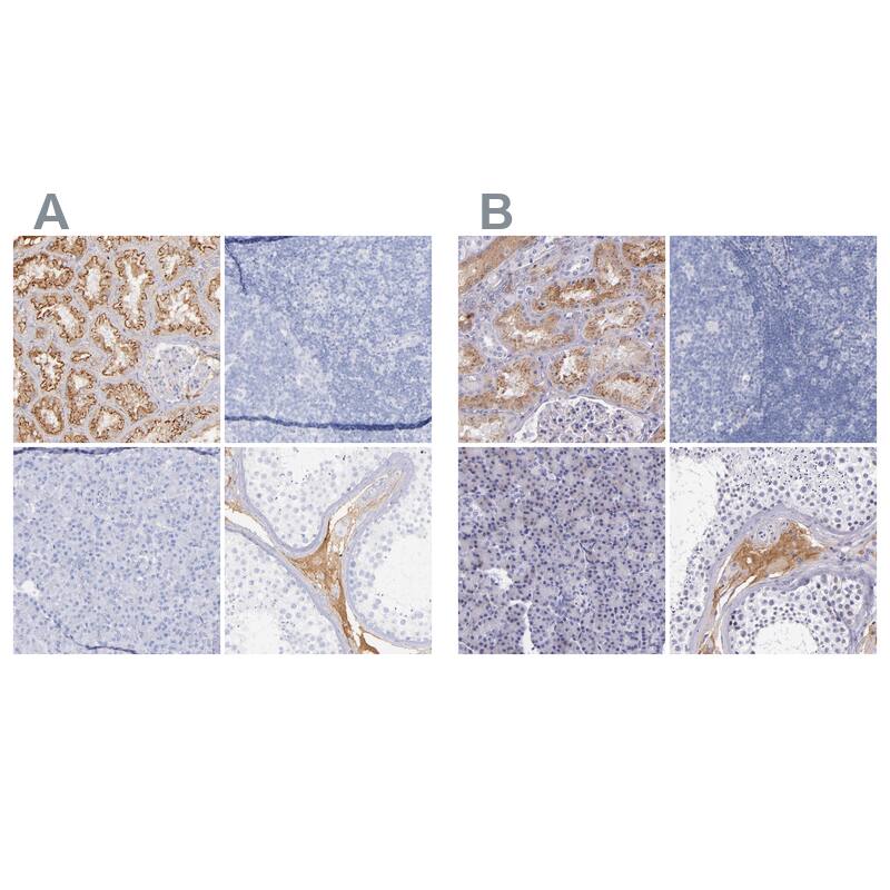Kininogen Antibody - BSA Free Immunohistochemistry-Paraffin: Kininogen Antibody - BSA Free [NBP1-89993]