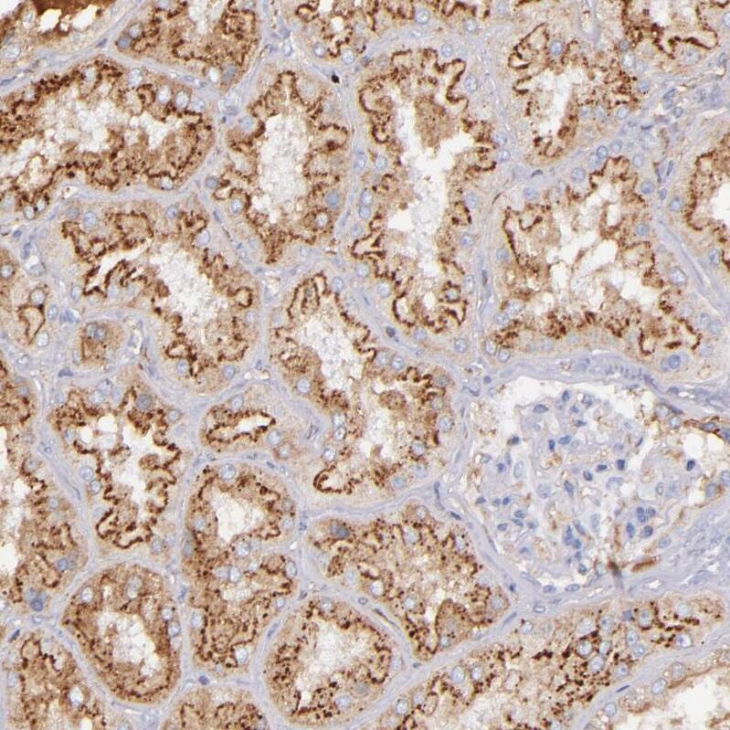 Kininogen Antibody - BSA Free Immunohistochemistry-Paraffin: Kininogen Antibody - BSA Free [NBP1-89993]