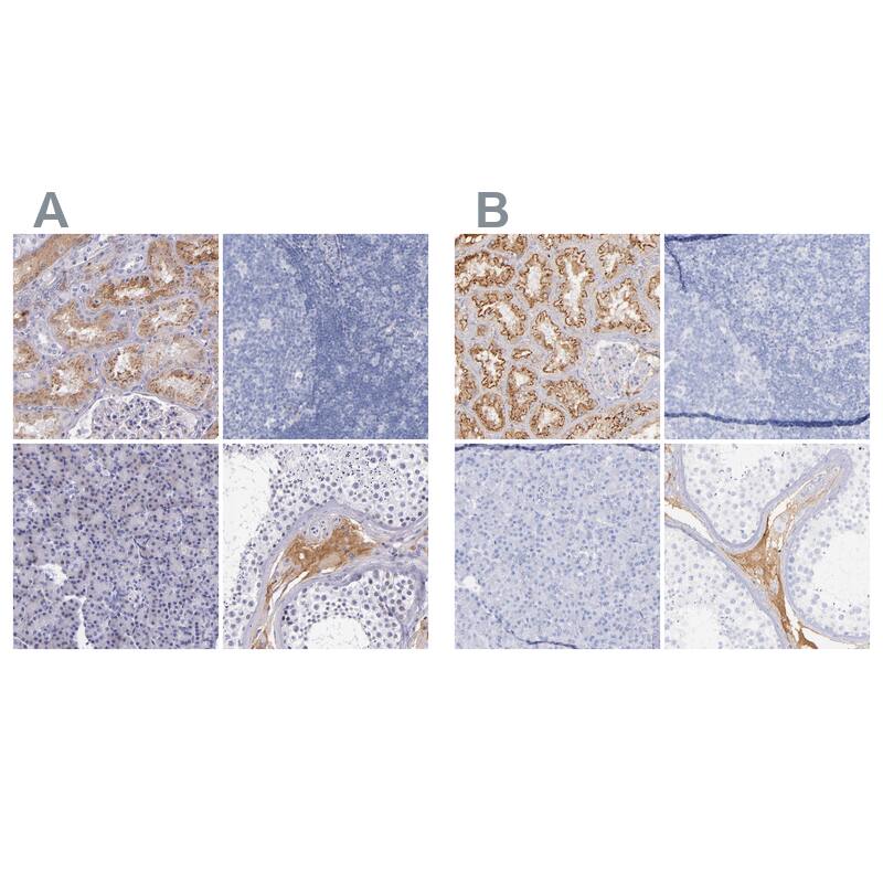 Kininogen Antibody - BSA Free Immunohistochemistry-Paraffin: Kininogen Antibody - BSA Free [NBP1-89994]