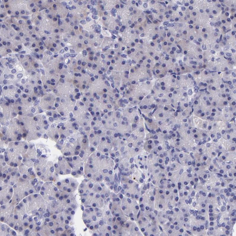 Kininogen Antibody - BSA Free Immunohistochemistry-Paraffin: Kininogen Antibody - BSA Free [NBP1-89994]