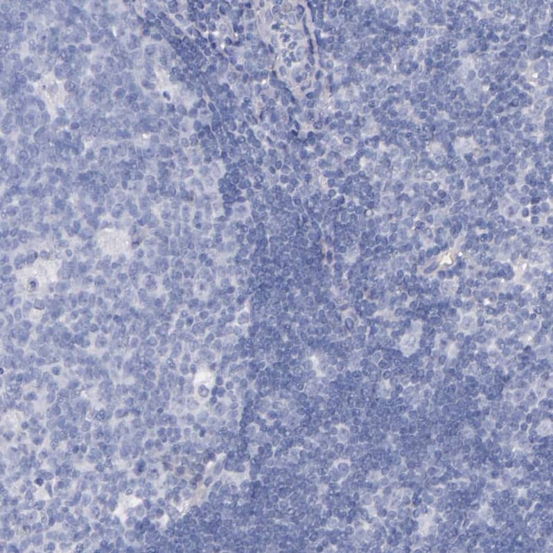 Kininogen Antibody - BSA Free Immunohistochemistry-Paraffin: Kininogen Antibody - BSA Free [NBP1-89994]