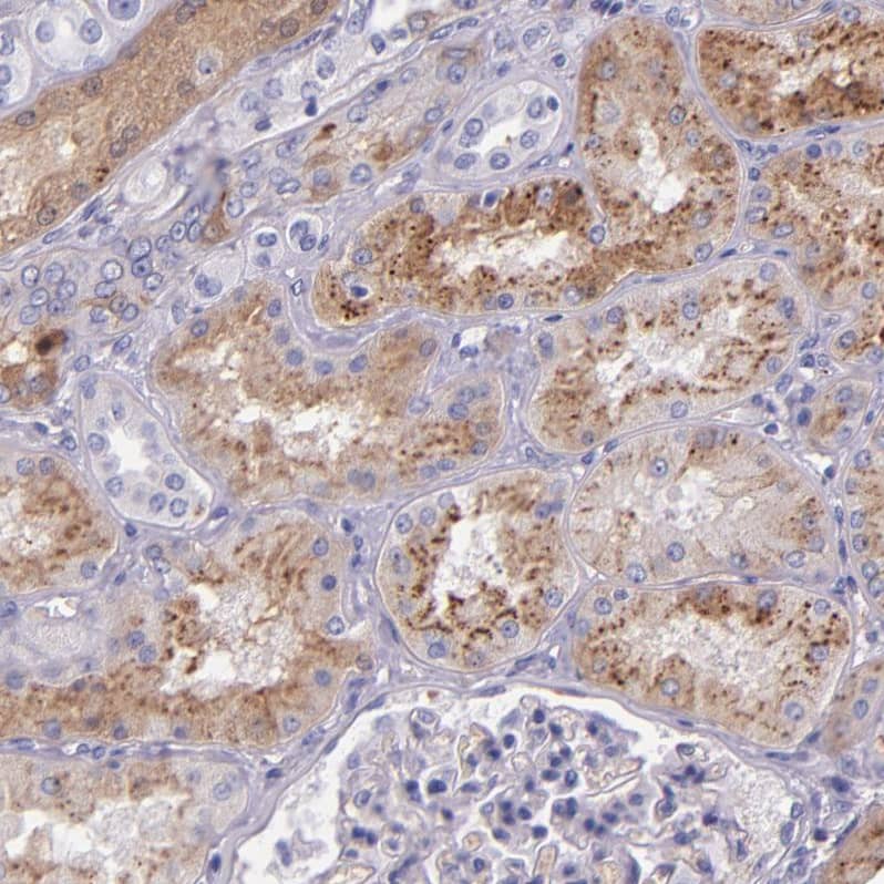 Kininogen Antibody - BSA Free Immunohistochemistry-Paraffin: Kininogen Antibody - BSA Free [NBP1-89994]