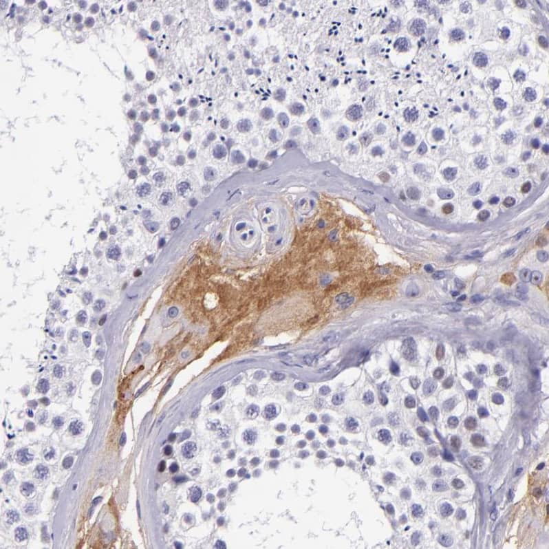 Kininogen Antibody - BSA Free Immunohistochemistry-Paraffin: Kininogen Antibody - BSA Free [NBP1-89994]
