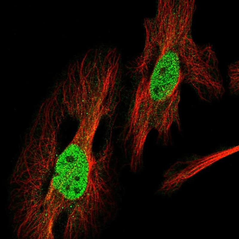 Breast cancer suppressor candidate 1 Antibody - BSA Free Immunocytochemistry/ Immunofluorescence: Breast cancer suppressor candidate 1 Antibody - BSA Free [NBP1-89997]