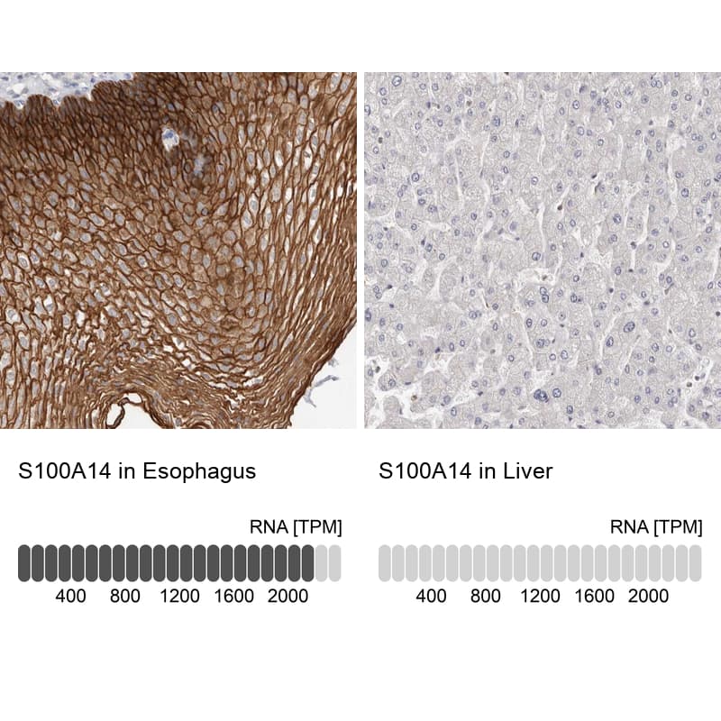 S100 calcium binding protein A14 Antibody - BSA Free Immunohistochemistry-Paraffin: S100 calcium binding protein A14 Antibody - BSA Free [NBP1-90000]