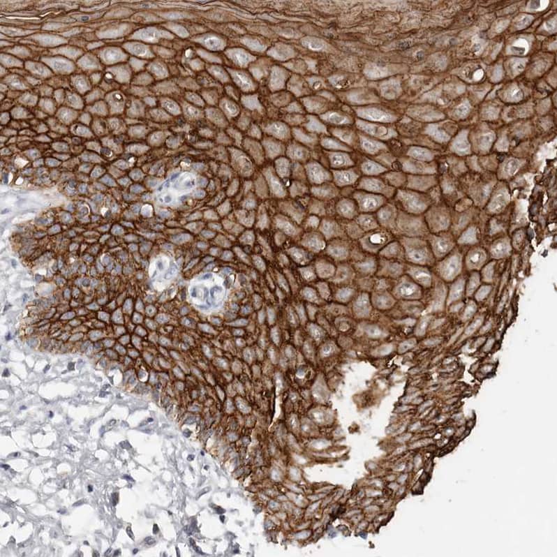 S100 calcium binding protein A14 Antibody - BSA Free Immunohistochemistry-Paraffin: S100 calcium binding protein A14 Antibody - BSA Free [NBP1-90000]