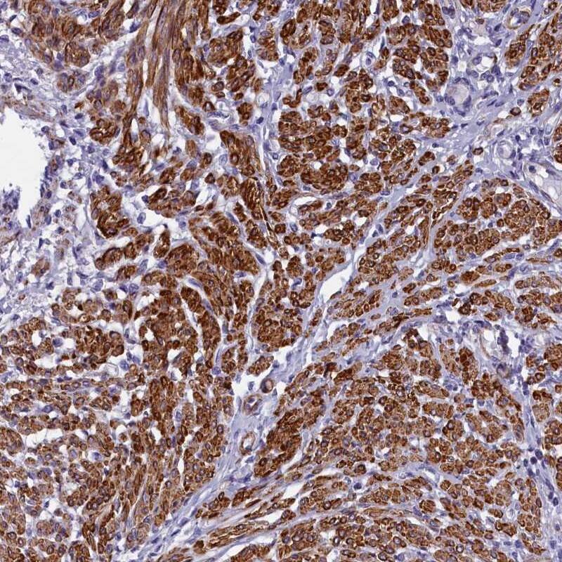 Bcl rambo Antibody - BSA Free Immunohistochemistry-Paraffin: Bcl rambo Antibody [NBP1-90002]