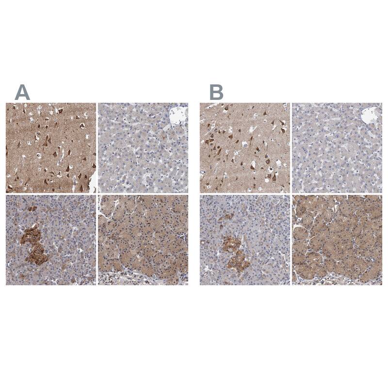 Neurobeachin Antibody - BSA Free Immunohistochemistry-Paraffin: Neurobeachin Antibody [NBP1-90003]