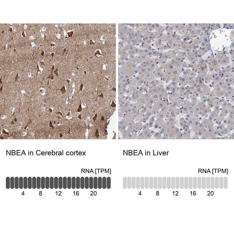 Neurobeachin Antibody - BSA Free Immunohistochemistry-Paraffin: Neurobeachin Antibody - BSA Free [NBP1-90003]