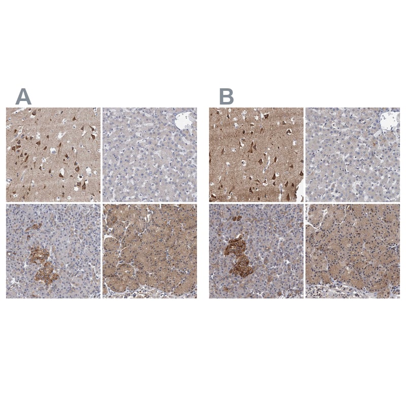 Neurobeachin Antibody - BSA Free Immunohistochemistry-Paraffin: Neurobeachin Antibody - BSA Free [NBP1-90004]
