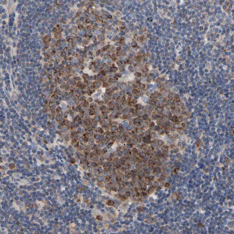 SCL/Tal1 Antibody Immunohistochemistry-Paraffin: SCL/Tal1 Antibody [NBP1-90005]