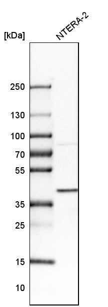 SCL/Tal1 Antibody Western Blot: TRIM26 Antibody [NBP1-90005]