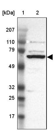GRK3 Antibody - BSA Free Western Blot: GRK3 Antibody - BSA Free [NBP1-90008]