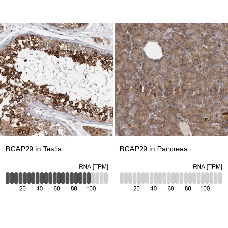 BAP29 Antibody - BSA Free Immunohistochemistry-Paraffin: BAP29 Antibody - BSA Free [NBP1-90009]