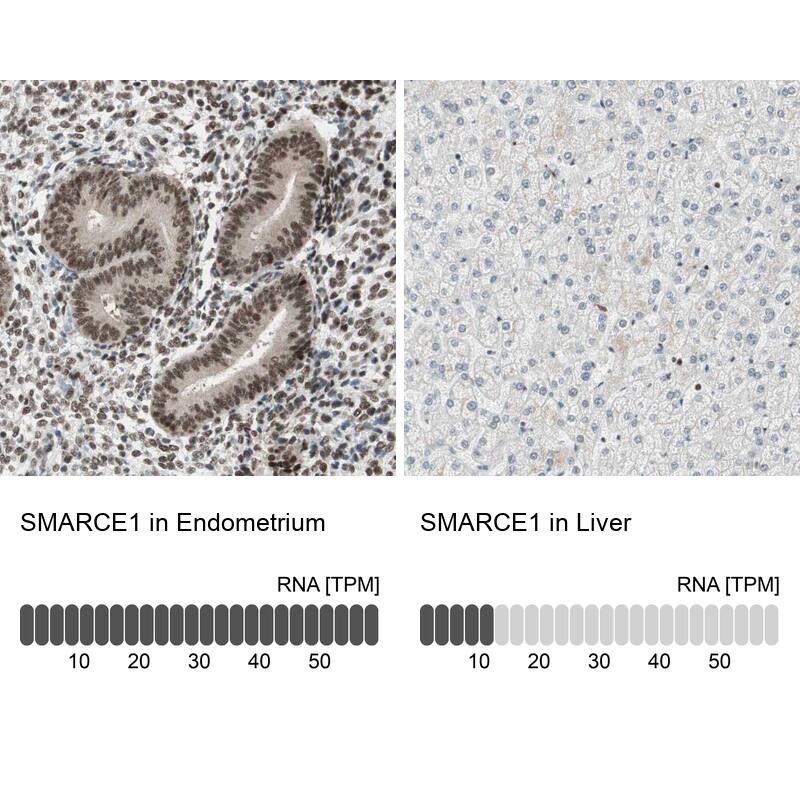 BAF57 Antibody - BSA Free Immunohistochemistry-Paraffin: BAF57 Antibody - BSA Free [NBP1-90012]