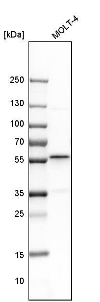 BAF57 Antibody - BSA Free Western Blot: BAF57 Antibody - BSA Free [NBP1-90012]