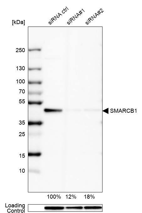 SNF5 Antibody - BSA Free Western Blot: SNF5 Antibody - BSA Free [NBP1-90013]