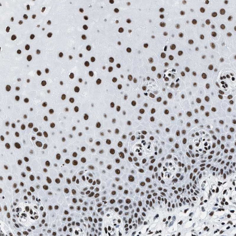 SMARCC2/BAF170 Antibody - BSA Free Immunohistochemistry-Paraffin: SMARCC2/BAF170 Antibody - BSA Free [NBP1-90017]