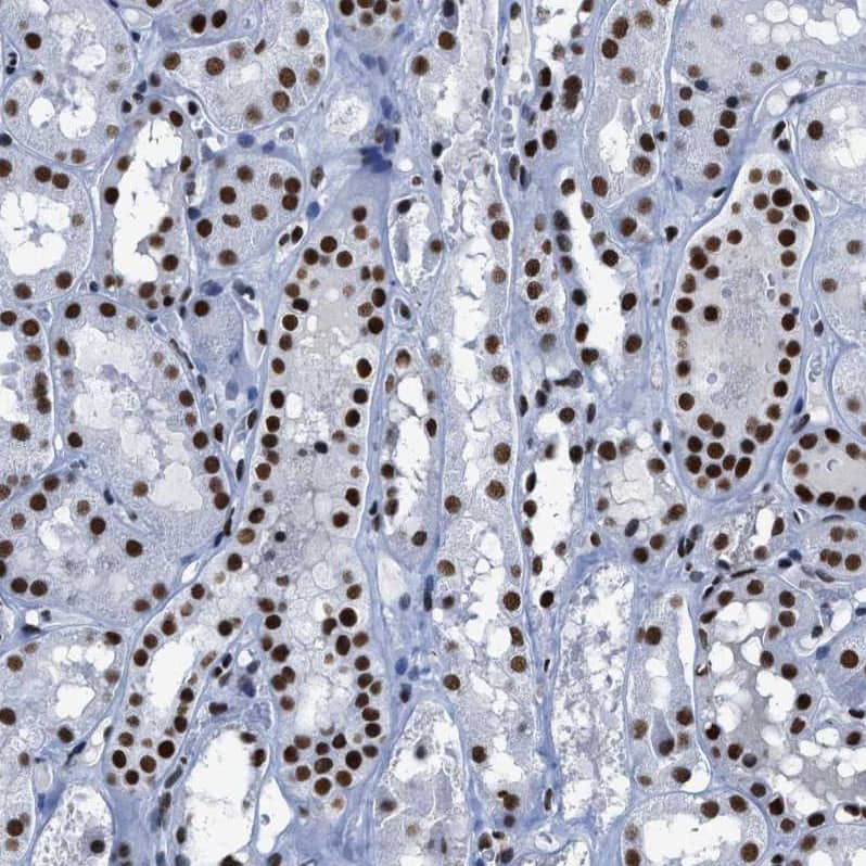 SMARCC2/BAF170 Antibody - BSA Free Immunohistochemistry-Paraffin: SMARCC2/BAF170 Antibody - BSA Free [NBP1-90017]