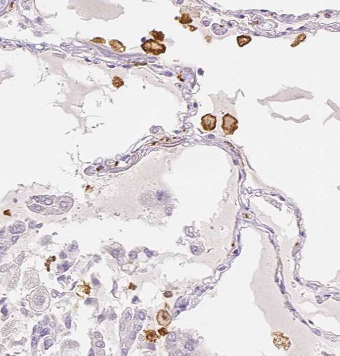 MMR/CD206/Mannose Receptor Antibody - BSA Free