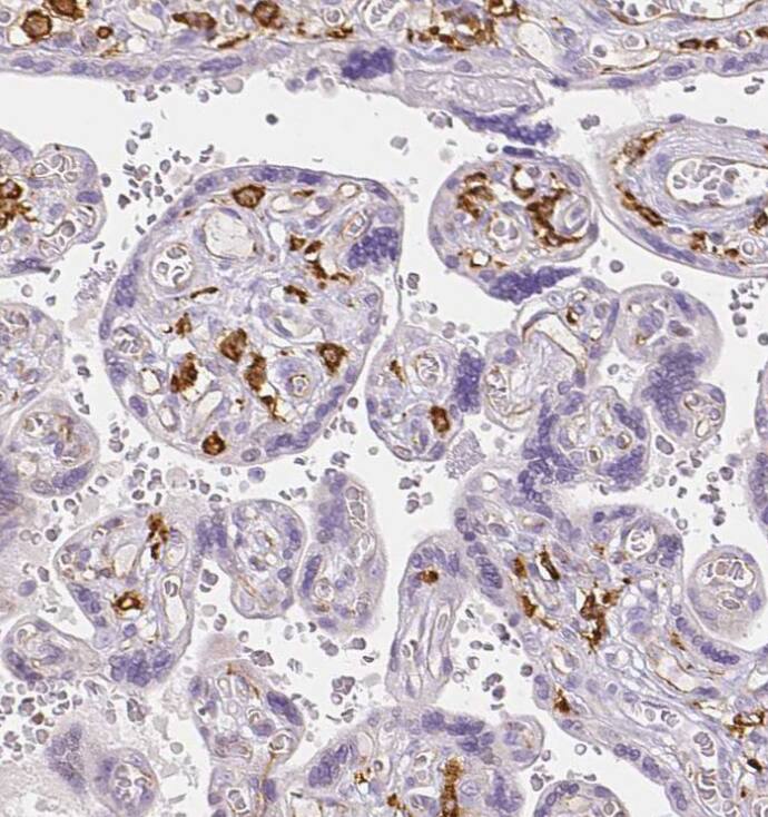 MMR/CD206/Mannose Receptor Antibody - BSA Free