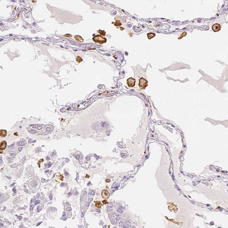 MMR/CD206/Mannose Receptor Antibody - BSA Free Immunohistochemistry-Paraffin: MMR/CD206/Mannose Receptor Antibody - BSA Free [NBP1-90020]